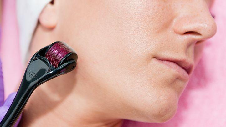 1280 Derma Roller Anti Ageing And Facial Scrubs Polishes Scar Removal Hair Regrowth